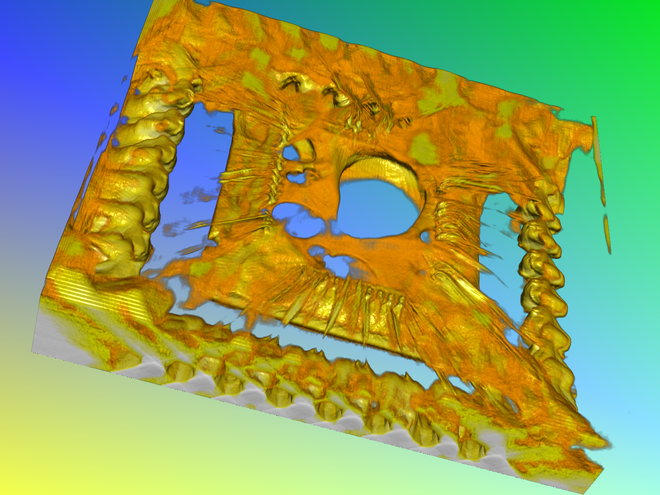 MXI Quadra 5® Pro - Image 4