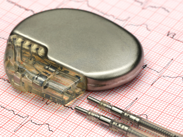 PaceMaker-Assembly.jpg