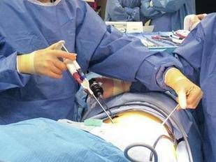 Biomaterial Delivery Devices